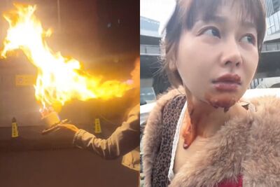 火舌吞臉！　陸甜美演員仿拍爆紅生日噴火蛋糕…慘遭「毀容」​