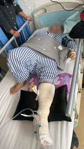 充電玩手機　陸女觸電「電流從手貫穿到腳」​