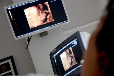 產檢見胎兒咧嘴笑！爸笑喊「好可愛」醫卻皺眉　夫妻崩潰終止妊娠​