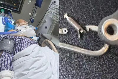 鎖扣突斷裂！60歲健身男遭划船機彈飛慘致「癱瘓」…妻崩潰​