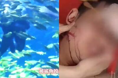 未告知!陸男潛水「遭鯊魚咬頭」頭破血流 員工還問要不要繼續